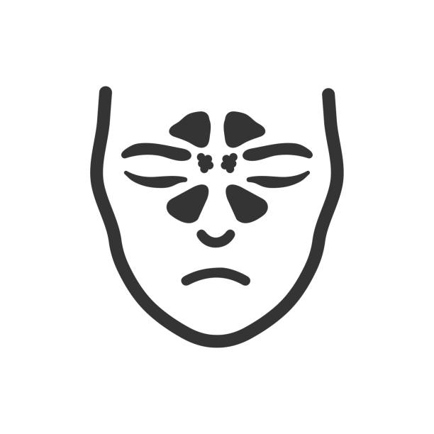 Chronic Sinusitis and Sinus Symptoms